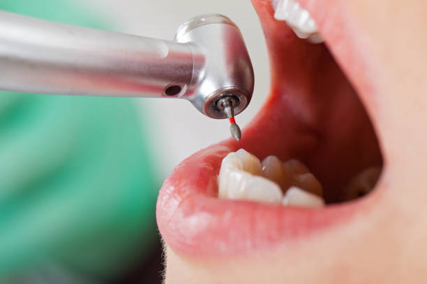 Best Broken or Cracked Tooth Emergency Dentist in Franklin, VA